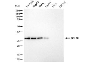Western blotting analysis using BCL10 antibody (ABIN7800913).