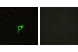 Peptide - +Western blot analysis of extracts from MCF-7 cells and HeLa cells, using CHRM2 antibody. (Muscarinic Acetylcholine Receptor M2 antibody  (Internal Region))