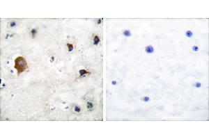 Peptide - +Immunohistochemical analysis of paraffin-embedded human brain tissue using Connexin 43 antibody. (Connexin 43/GJA1 antibody)