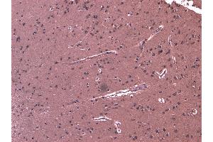 (ABIN263162) (8 μg/mL) staining of paraffin embedded Human Cortex. (DHX58 antibody  (C-Term))