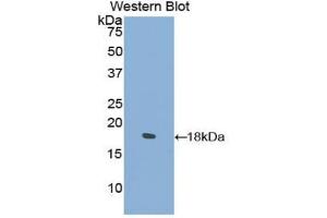 Western blot analysis of the recombinant protein. (COL2A1 antibody  (AA 677-817))