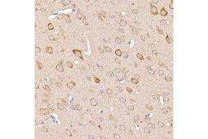 Immunohistochemistry of paraffin-embedded mouse brain using [KO Validated] TR Rabbit pAb (ABIN3021164, ABIN3021165, ABIN3021166 and ABIN1513640) at dilution of 1:250 (40x lens).