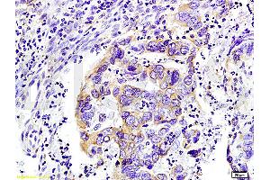 WNK3 antibody  (AA 451-550)