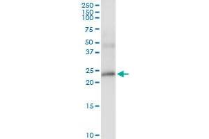 Immunoprecipitation of BTC transfected lysate using anti-BTC MaxPab rabbit polyclonal antibody and Protein A Magnetic Bead , and immunoblotted with BTC purified MaxPab mouse polyclonal antibody (B02P) . (Betacellulin antibody  (AA 1-178))