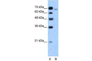 WB建议的抗-MLLT4抗体滴定：1。（Afadin抗体（N-末端））