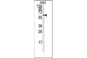 Image no. 1 for anti-Cytochrome P450, Family 17, Subfamily A, Polypeptide 1 (CYP17A1) (Middle Region) antibody (ABIN360245) (CYP17A1 antibody  (Middle Region))