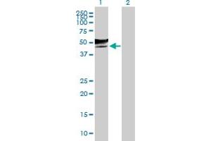 Western Blot analysis of GCNT2 expression in transfected 293T cell line by GCNT2 MaxPab polyclonal antibody. (GCNT2 antibody  (AA 1-402))
