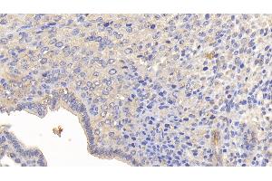 Detection of MMP13 in Mouse Uterus Tissue using Polyclonal Antibody to Matrix Metalloproteinase 13 (MMP13) (MMP13 antibody  (AA 66-238))