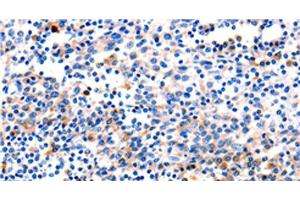 Immunohistochemistry of paraffin-embedded Human tonsil tissue using GADD45 gamma Polyclonal Antibody at dilution 1:120 (GADD45G antibody)