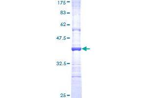 Image no. 1 for Matrix Metallopeptidase 26 (MMP26) (AA 152-261) protein (GST tag) (ABIN1311080) (MMP26 Protein (AA 152-261) (GST tag))