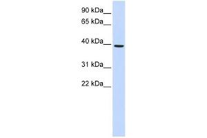 MOGAT2 antibody used at 1 ug/ml to detect target protein. (MOGAT2 antibody  (Middle Region))