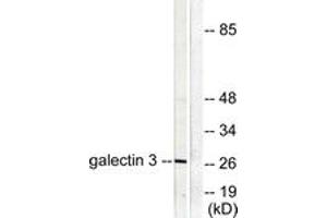 Western blot analysis of extracts from HeLa cells, using Galectin 3 Antibody. (Galectin 3 antibody  (AA 141-190))