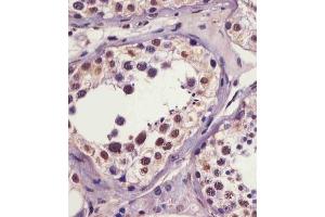 (ABIN6241064 and ABIN6578961) staining IRAK1 in human testis tissue sections by Immunohistochemistry (IHC-P - paraformaldehyde-fixed, paraffin-embedded sections). (IRAK1 antibody  (pSer376))