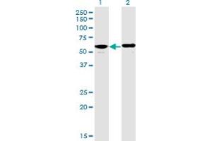 Western Blot analysis of PPP2R5D expression in transfected 293T cell line by PPP2R5D monoclonal antibody (M01), clone 4E12. (PPP2R5D antibody  (AA 1-602))