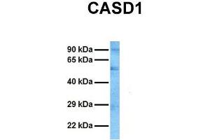 Host:  Rabbit  Target Name:  CASD1  Sample Tissue:  Human HT1080  Antibody Dilution:  1. (CASD1 antibody  (N-Term))