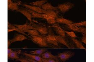 Immunofluorescence analysis of C6 cells using COMMD5 Polyclonal Antibody at dilution of 1:100. (COMMD5 antibody)