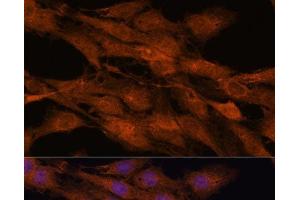 Immunofluorescence analysis of C6 cells using COMMD5 Polyclonal Antibody at dilution of 1:100.
