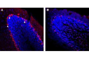 Expression of TRPC3 in mouse cerebellum.