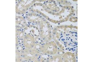 Immunohistochemistry of paraffin-embedded mouse kidney using CHMP1B antibody (ABIN5974811) at dilution of 1/100 (40x lens). (CHMP1B antibody)