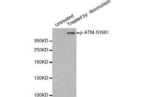 Western blot analysis of extracts of 293 cells, using phospho-ATM-S1981 antibody. (ATM antibody  (pSer1981))