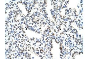 WDR6 antibody was used for immunohistochemistry at a concentration of 4-8 ug/ml to stain Alveolar cells (arrows) in Human Lung. (WDR6 antibody  (C-Term))
