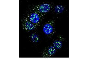 Confocal immunofluorescent analysis of MGMT Antibody (N-term) (ABIN657769 and ABIN2846745) with MCF-7 cell followed by Alexa Fluor 488-conjugated goat anti-rabbit lgG (green). (MGMT antibody  (N-Term))