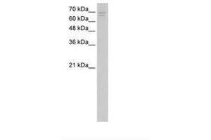 Image no. 1 for anti-Calcium Channel, Voltage-Dependent, beta 2 Subunit (CACNB2) (AA 394-443) antibody (ABIN204951) (CACNB2 antibody  (AA 394-443))