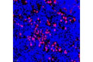 Immunofluorescence of paraffin embedded mouse spleen using ANXA3 (ABIN7073065) at dilution of 1: 300 (400x lens) (Annexin A3 antibody)