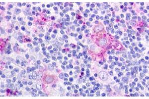Image no. 1 for anti-Chemokine-Like Receptor 1 (CMKLR1) (N-Term) antibody (ABIN1048448) (CMKLR1 antibody  (N-Term))