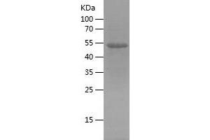 Western Blotting (WB) image for Reticulon 3 (RTN3) (AA 128-358) protein (His-IF2DI Tag) (ABIN7283835) (Reticulon 3 Protein (RTN3) (AA 128-358) (His-IF2DI Tag))