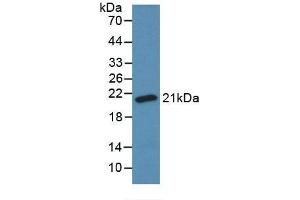 Detection of Recombinant SOD1, Bovine using Monoclonal Antibody to Superoxide Dismutase 1 (SOD1) (SOD1 antibody  (AA 2-152))