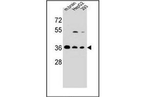 Western blot analysis of FBXO2 Antibody (FBXO2 antibody  (C-Term))