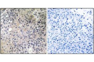 Immunohistochemistry analysis of paraffin-embedded human lung tissue using SHC3 antibody. (SHC3 antibody)