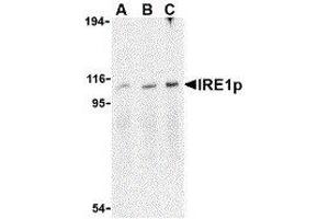 Western Blotting (WB) image for anti-Endoplasmic Reticulum To Nucleus Signaling 1 (ERN1) (C-Term) antibody (ABIN2475138) (ERN1 antibody  (C-Term))