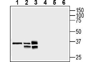 Western blot analysis of mouse brain lysates (lanes 1 and 4), rat brain lysates (lanes 2 and 5) and rat heart lysates (lanes 3 and 6):1-3.