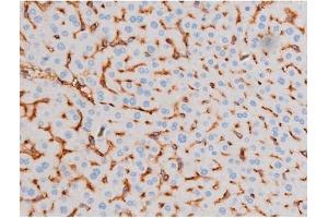 Immunohistochemistry (IHC) image for anti-Insulin Receptor Substrate 1 (IRS1) (pSer639) antibody (ABIN6256390)