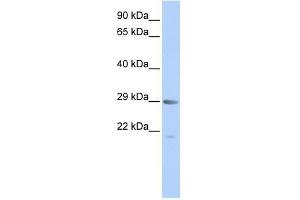 MORF4 antibody used at 0. (MORF4 antibody  (Middle Region))