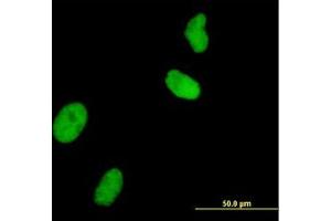 Image no. 2 for anti-Ubiquitin-Like, Containing PHD and RING Finger Domains, 1 (UHRF1) (AA 694-794) antibody (ABIN466202) (UHRF1 antibody  (AA 694-794))