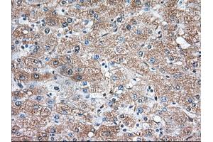 Immunohistochemical staining of paraffin-embedded Human liver tissue using anti-TBXAS1 mouse monoclonal antibody. (TBXAS1 antibody)