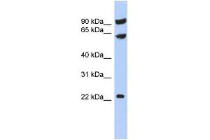 WB Suggested Anti-TIGD3 Antibody Titration:  0. (TIGD3 antibody  (Middle Region))