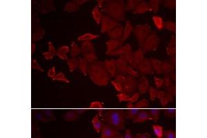 Immunofluorescence analysis of U2OS cells using MARCKSL1 Polyclonal Antibody (MARCKSL1 antibody)