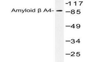 Image no. 1 for anti-Amyloid beta (A4) Precursor Protein (APP) antibody (ABIN265307) (APP antibody)
