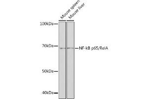 Western blot analysis of extracts of various cell lines, using NF-kB p65/RelA antibody (ABIN7268995) at 1:1000 dilution. (NF-kB p65 antibody)