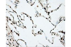 Immunohistochemical staining of paraffin-embedded prostate tissue using anti-DAPK2 mouse monoclonal antibody. (DAPK2 antibody)
