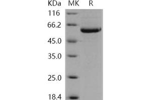 Western Blotting (WB) image for serine/threonine Kinase 4 (STK4) (Active) protein (His tag) (ABIN7317074) (STK4 Protein (His tag))
