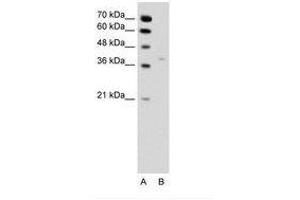 Image no. 2 for anti-Hydroxysteroid (17-Beta) Dehydrogenase 1 (HSD17B1) (N-Term) antibody (ABIN6736344)