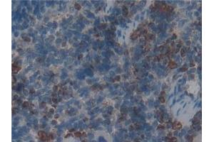 Detection of MPO in Rat Spleen Tissue using Polyclonal Antibody to Myeloperoxidase (MPO) (Myeloperoxidase antibody  (AA 134-263))