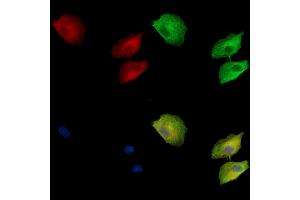 ABIN7095075 and ABIN7099131 staining  cells by IF/ICC.