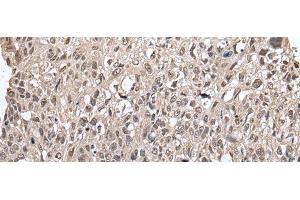 MAP1D antibody