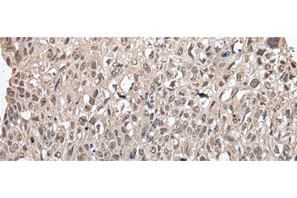 MAP1D antibody